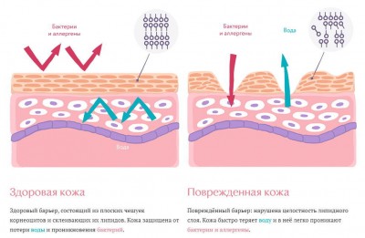 Раздражение.jpg