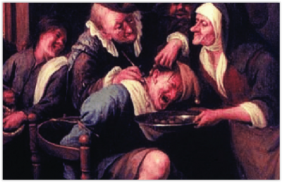 Bradobrei.167a.Jan Steen (1626-1679.)extraction of the stone of madness.PNG